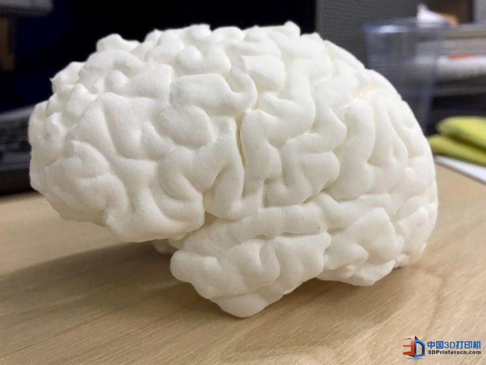 未來醫(yī)療行業(yè) 3D打印技術(shù)融入其中的四種方式
3D醫(yī)療行業(yè),3D打印心臟,3D打印大腦,3D打印應(yīng)用,3D打印領(lǐng)域,3D打印和醫(yī)療的關(guān)系,3D打印平臺(tái),3D打印服務(wù),3d打印企業(yè)服務(wù)平臺(tái)