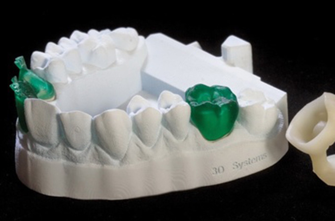 德國率先引入3D打印牙齒技術 全程體驗“無痛”種牙-e鍵打印|3D打印服務
3d打印牙齒,3D打印種牙,無痛種牙,3D打印平臺,3D打印服務,南京哪里有3D打印,南京3D打印廠家,南京3D打印服務
