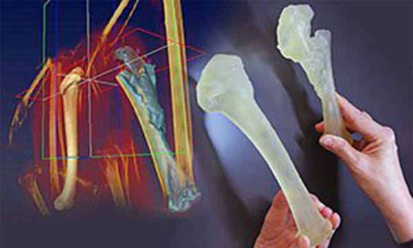 左邊是雄鷹健康的肱骨,右邊是雄鷹實(shí)際受傷的骨頭的復(fù)制品