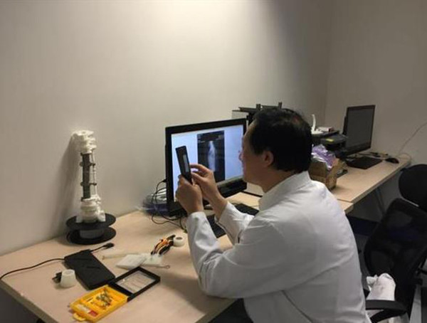 3D打印醫(yī)療應用成功案例 北醫(yī)三院3D打印定制人工椎體植入術(shù)