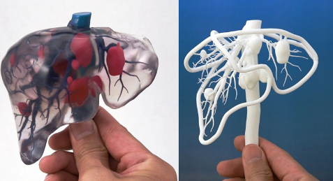 個(gè)性化醫(yī)療3D打印實(shí)戰(zhàn)案例與研究成果的問答整理_3d打印服務(wù)公司 個(gè)性化醫(yī)療3D打印實(shí)戰(zhàn)案例與研究成果的問答整理_3d打印服務(wù)公司