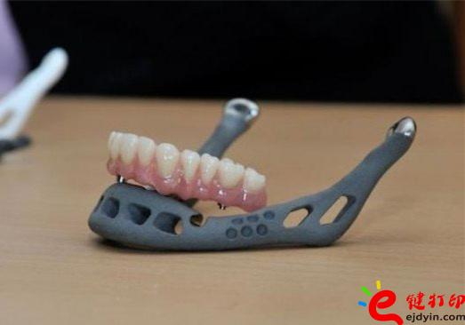3D打印牙嵌體和牙套哪種更好?3D打印牙齒/隱形牙套/牙冠/模型/成品價(jià)格表 3D打印牙嵌體和牙套哪種更好?3D打印牙齒/隱形牙套/牙冠/模型/成品價(jià)格表