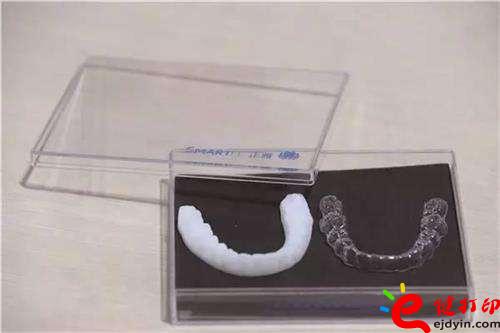 3D打印牙嵌體和牙套哪種更好?3D打印牙齒/隱形牙套/牙冠/模型/成品價(jià)格表 3D打印牙嵌體和牙套哪種更好?3D打印牙齒/隱形牙套/牙冠/模型/成品價(jià)格表